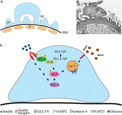 Glucose Transporters in Diabetic Kidney Disease—Friends or Foes?